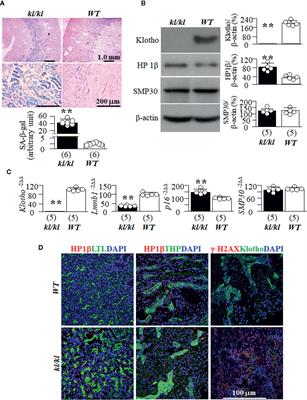 High Phosphate Induces and Klotho Attenuates Kidney Epithelial Senescence and Fibrosis